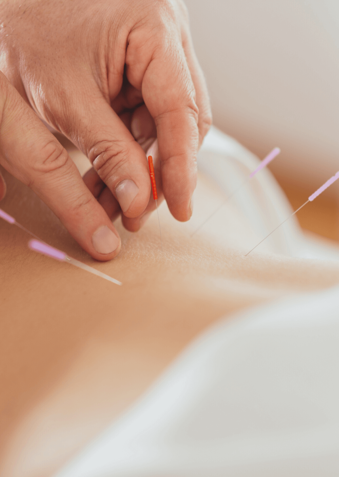 v-curso-electroneuroacupuntura